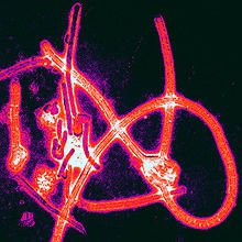 photo colorisée virus Ebola